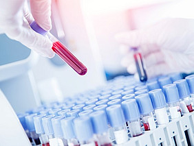 S4DX: 5 million euros for digital fingerprinting of human blood samples
